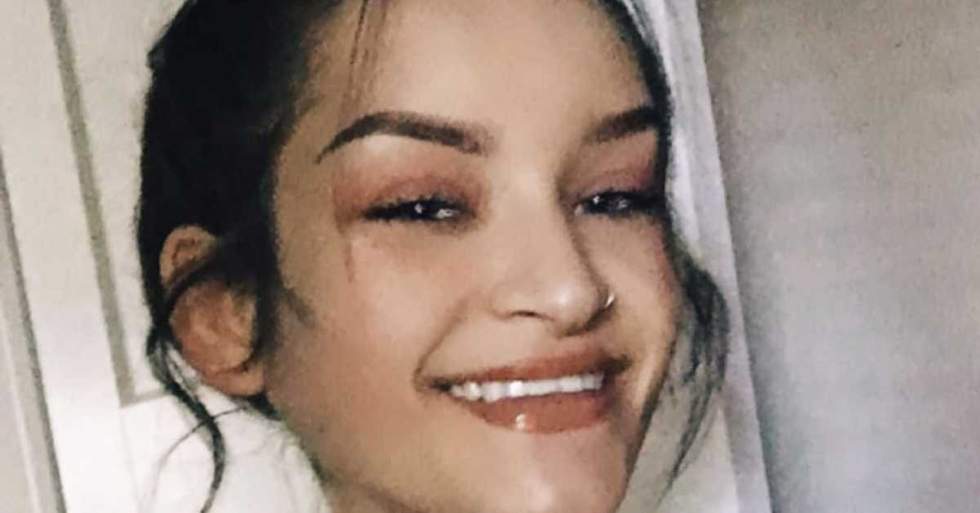 She's 21-Years-Old And In Congestive Heart Failure