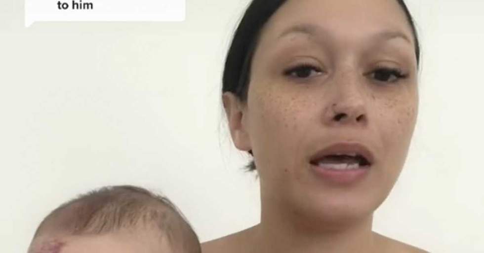 TikTok Mom Slammed With Hate After Deciding To Remove Her Six-Month-Old Son's Port-Wine Stain Birthmark